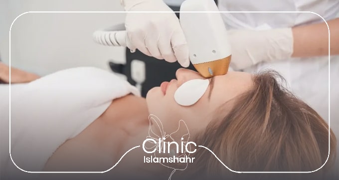 لیزر موهای زائد دائمی چیست و چگونه عمل می‌کند؟