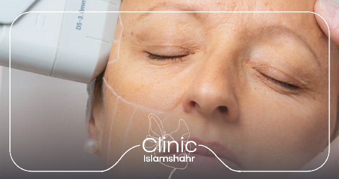  هایفوتراپی چیست؟ معرفی علمی و کاربردی روش هایفوتراپی صورت