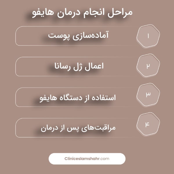 مراحل انجام درمان هایفوتراپی گردن