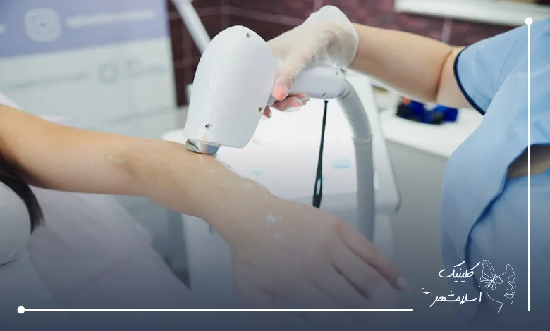 انواع دستگاه‌های لیزر موجود در بهترین مرکز لیزر اسلامشهر