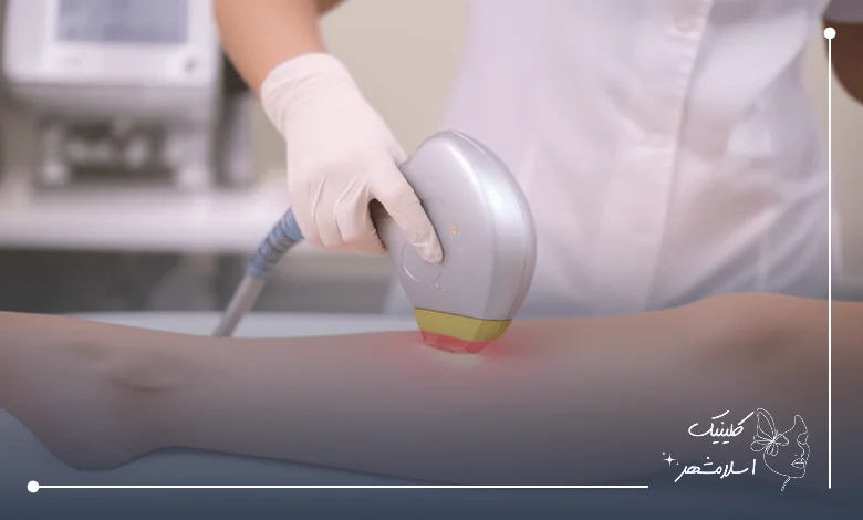 چه شرایطی برای انجام لیزر موهای زائد لازم است؟