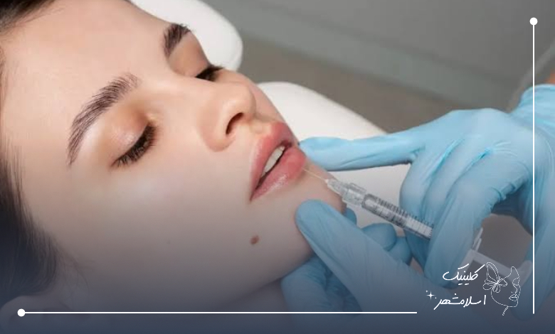 فواید تزریق ژل لب در کلینیک اسلامشهر