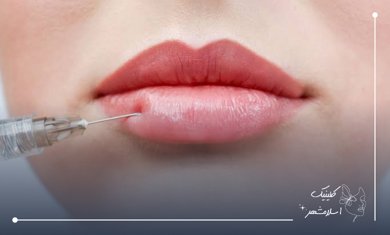 چطور ژل لب مناسب خود را انتخاب کنیم؟