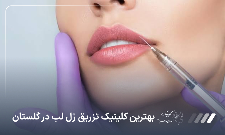 بهترین کلینیک تزریق ژل لب در گلستان⚡【آپدیت‌سال1405】