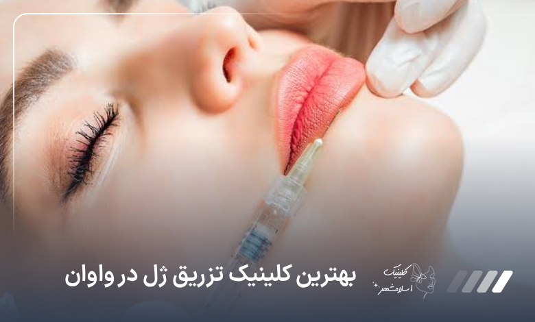 بهترین کلینیک تزریق ژل لب در واوان❤️【آپدیت‌سال1405】⚡