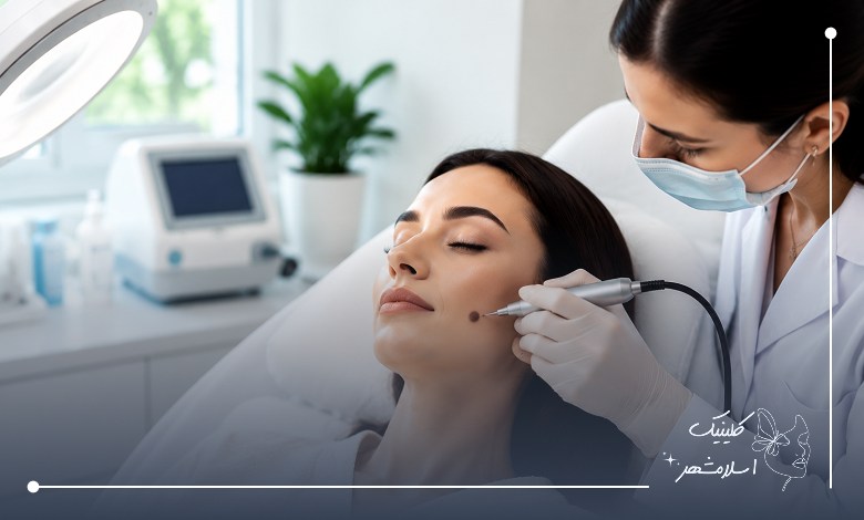 نکات مهم پیش از خال‌برداری