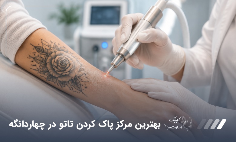 بهترین مرکز پاک کردن تاتو در چهاردانگه ⭐【سال 1405】❤