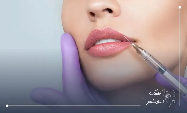 بهترین برندهای ژل لب در کلینیک اسلامشهر