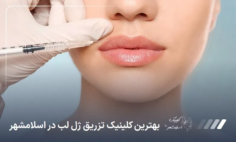 بهترین کلینیک تزریق ژل لب در اسلام‌شهر