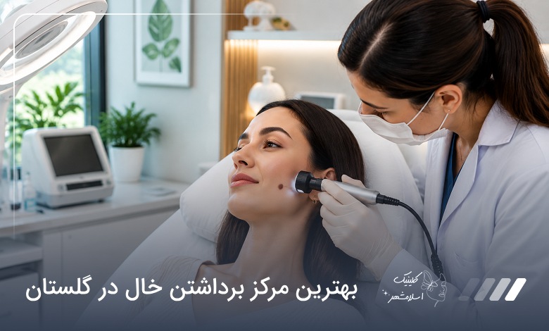 بهترین مرکز برداشتن خال در گلستان