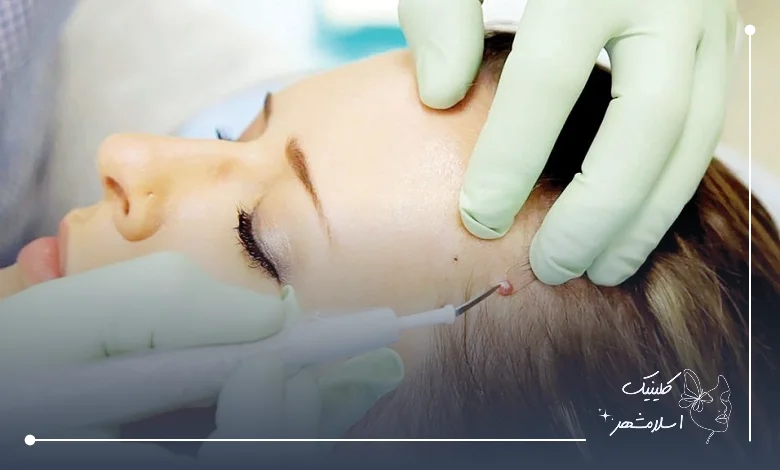 روش‌های مختلف برداشتن خال