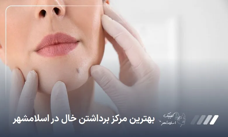 بهترین مرکز برداشتن خال در اسلام‌شهر