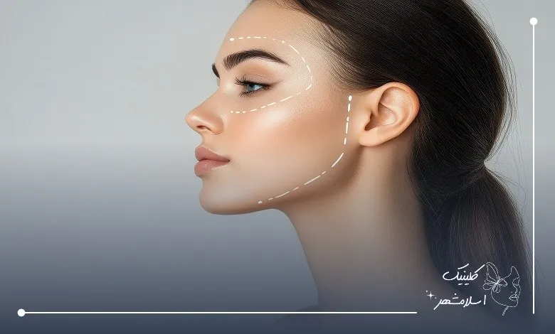  مراحل انجام عمل بوکال فت در کلینیک اسلام‌شهر