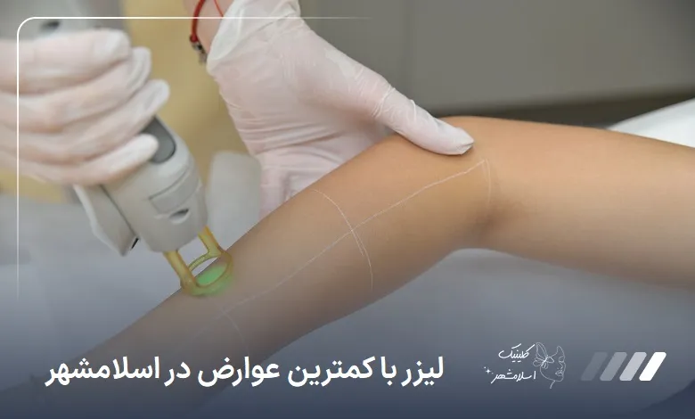 لیزر با کمترین عوارض در اسلام‌شهر ❤【سال1404】⚡