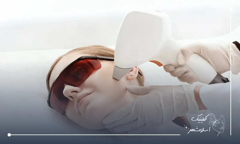 مزایای لیزر موهای زائد نسبت به روشهای سنتی