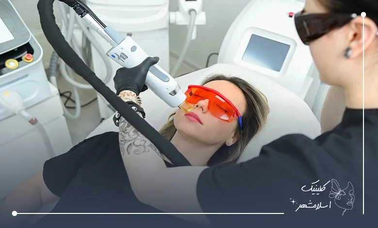 نکات مهم قبل و بعد از جلسات لیزر موهای زائد