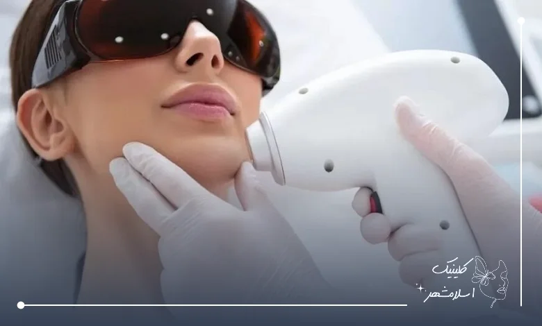 چه افرادی کاندیدای مناسبی برای شات لیزر هستند؟