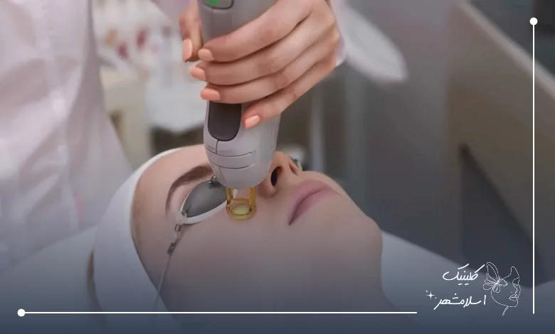  مراقبت‌های پیش از و پس از درمان لیزر