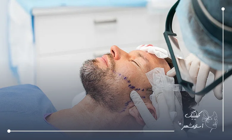 مراقبت‌های بعد از کاشت ریش برای نتیجه بهتر