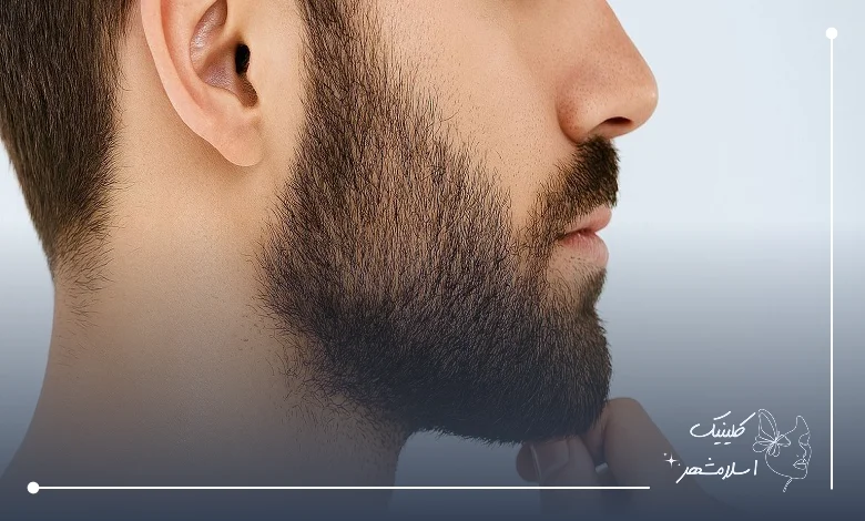 نکات مهم مراجعه به کلینیک تخصصی کاشت ریش در اسلامشهر