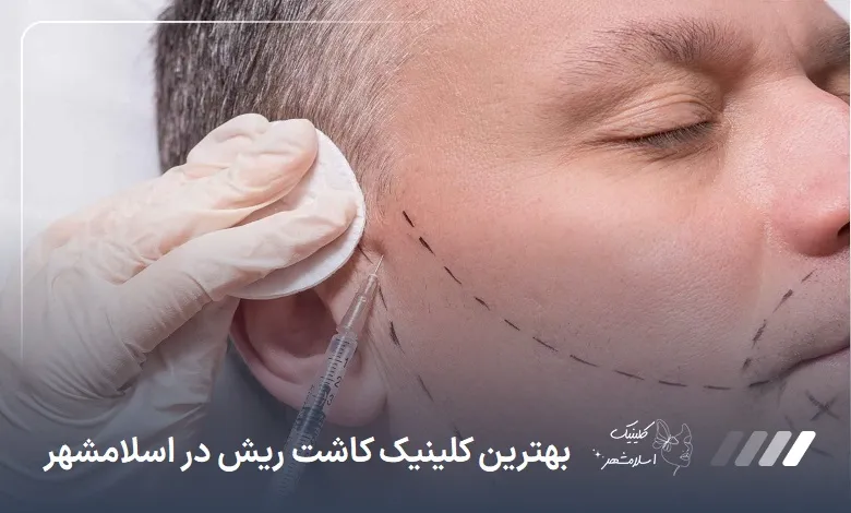 بهترین کلینیک کاشت ریش در اسلامشهر