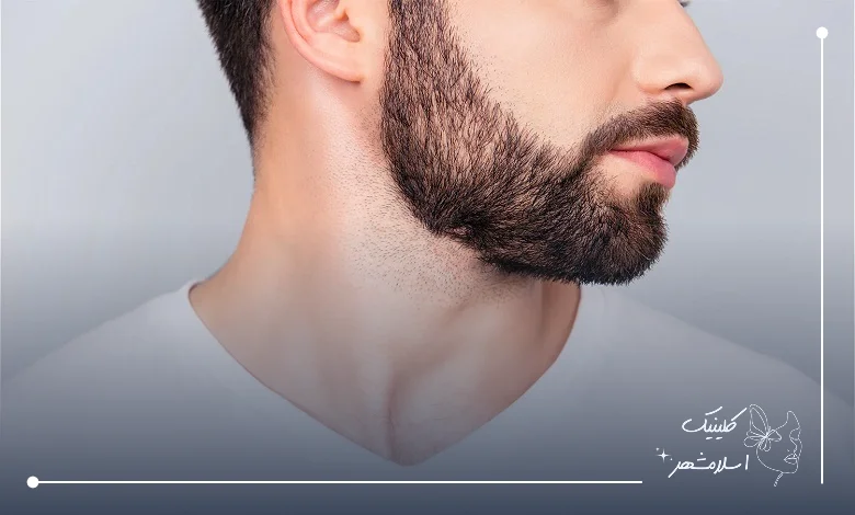مزایای مراجعه به کلینیک تخصصی کاشت ریش در رباط کریم