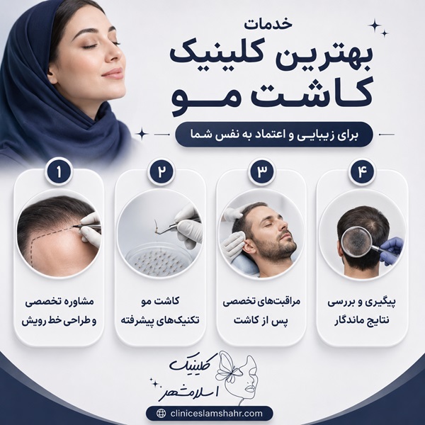 ویژگی‌های بهترین کلینیک کاشت مو در نسیم شهر