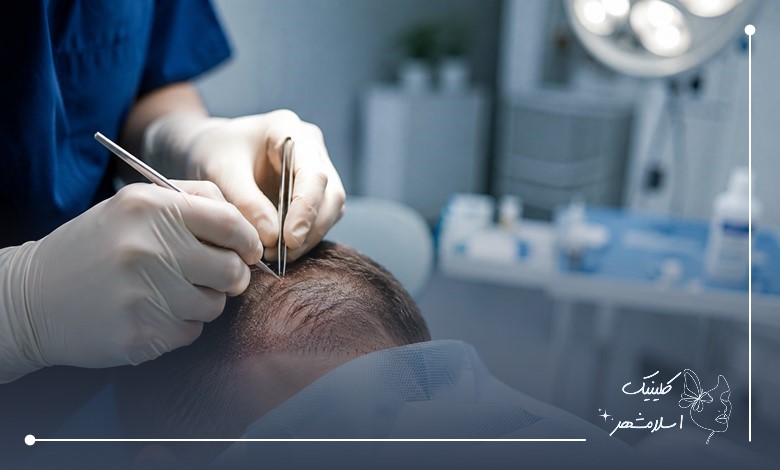 نکات مهم قبل از مراجعه به کلینیک تخصصی کاشت مو در رباط کریم