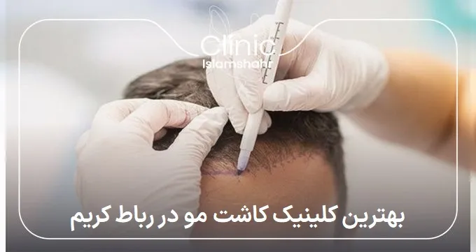 بهترین کلینیک کاشت مو در رباط کریم❤️【سال1404】