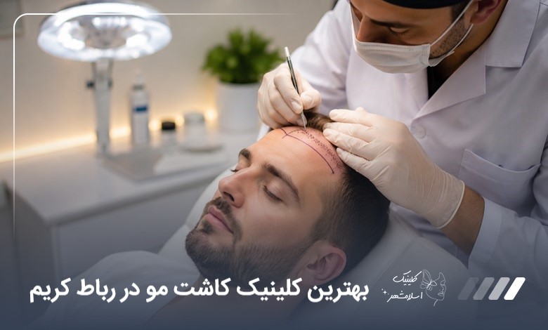 بهترین کلینیک کاشت مو در رباط کریم