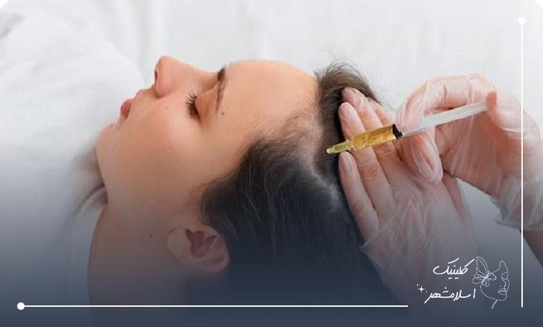 راهنمای انتخاب بهترین مرکز مزوتراپی مو در اسلامشهر