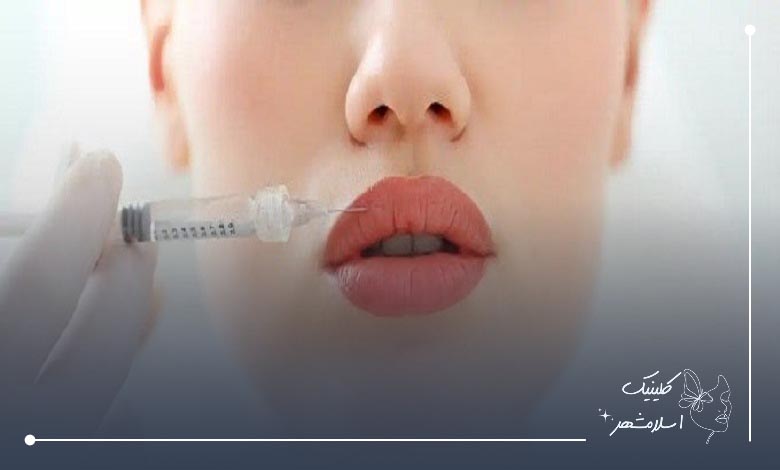 خدمات ارائه شده توسط بهترین کلینیک تزریق ژل لب در اسلامشهر