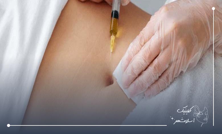 ضرورت مراجعه به بهترین مرکز فیلر بادی در اسلامشهر