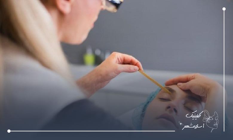 خدمات بهترین مرکز کاشت ابرو ارزان در اسلامشهر 