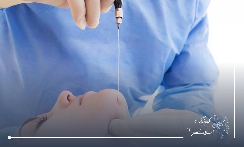 مراقبت های ضروری بعد از انجام ساکشن غبغب