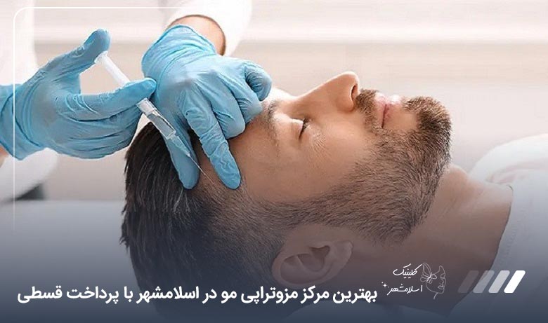 بهترین مرکز مزوتراپی مو در اسلامشهر+ قیمت ارزان و پرداخت قسطی【سال1405】⚡
