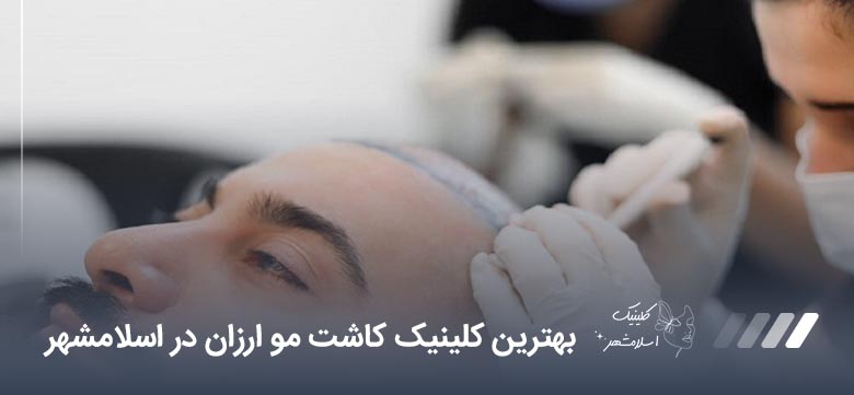 بهترین کلینیک کاشت مو ارزان در اسلامشهر【سال1405】⭐