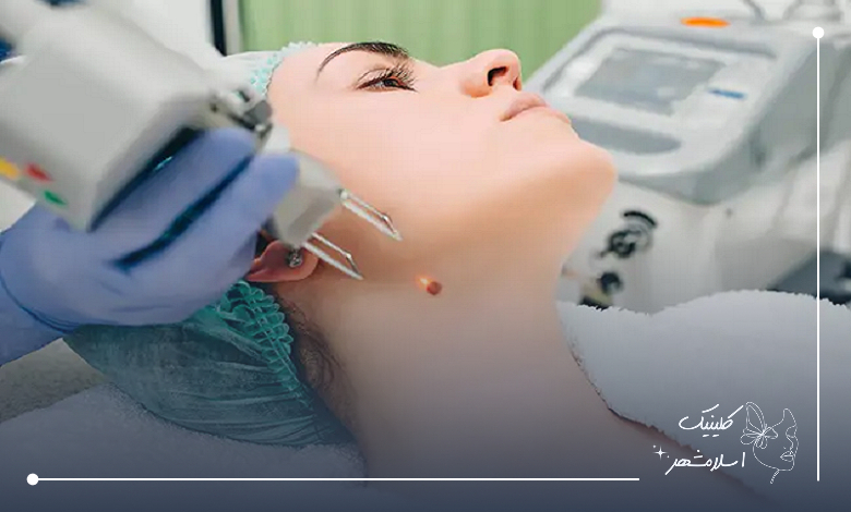 راهنمای انتخاب بهترین مرکز برداشتن خال ارزان در شهریار