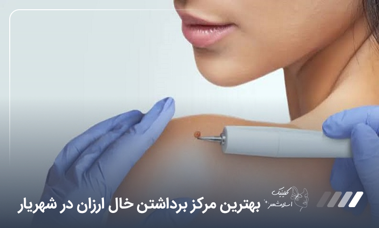 بهترین مرکز برداشتن خال ارزان در شهریار【سال1405】⭐