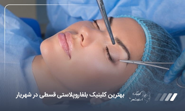 بهترین کلینیک بلفاروپلاستی قسطی در شهریار