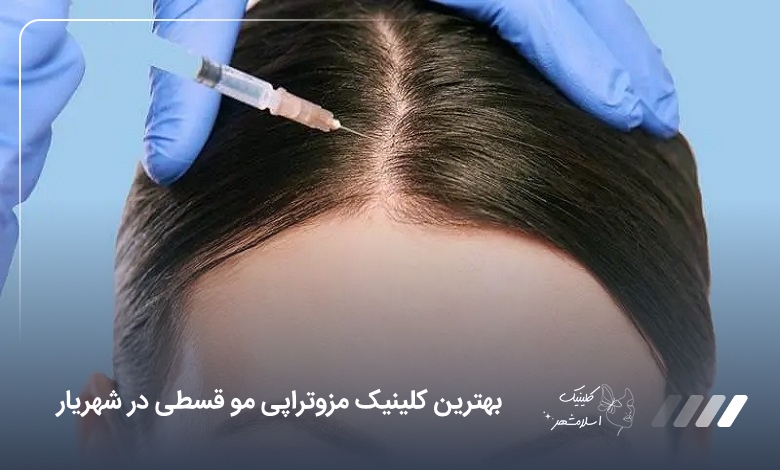 بهترین کلینیک مزوتراپی مو قسطی در شهریار