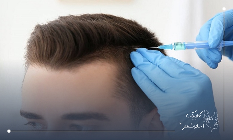 فرآیند خدمات کلینیک مزوتراپی مو قسطی در شهریار