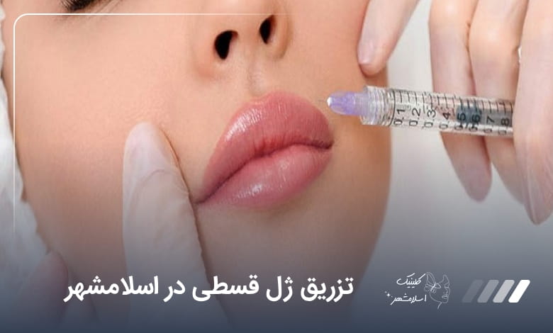 تزریق ژل قسطی در اسلامشهر