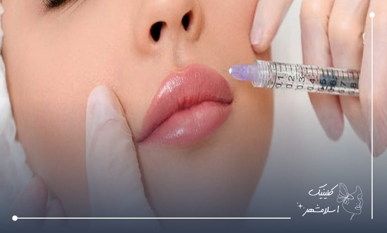 مزایای تزریق فیلر و ژل به صورت اقساطی
