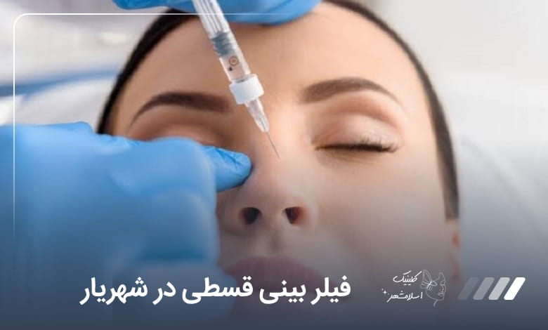 فیلر بینی قسطی در شهریار
