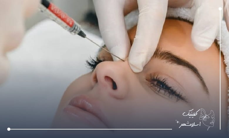 فیلر بینی اقساطی برای چه کسانی مناسب است؟