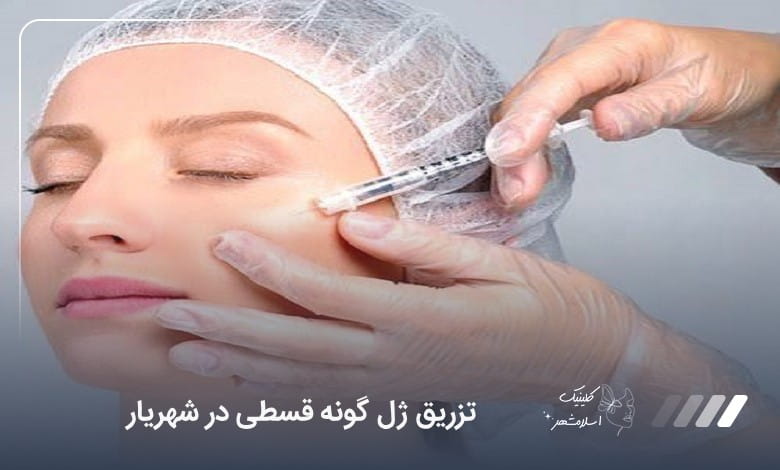 تزریق ژل گونه قسطی در شهریار ❤️【سال1405】