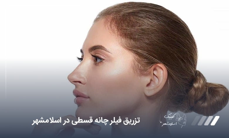 تزریق فیلر چانه قسطی در اسلامشهر❤️【سال1405】