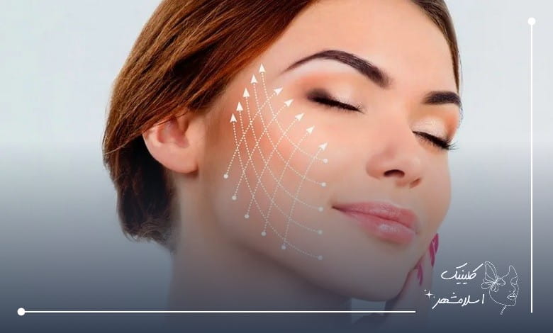 قبل از انجام لیفت صورت با نخ قسطی چه نکاتی را باید بدانید؟
