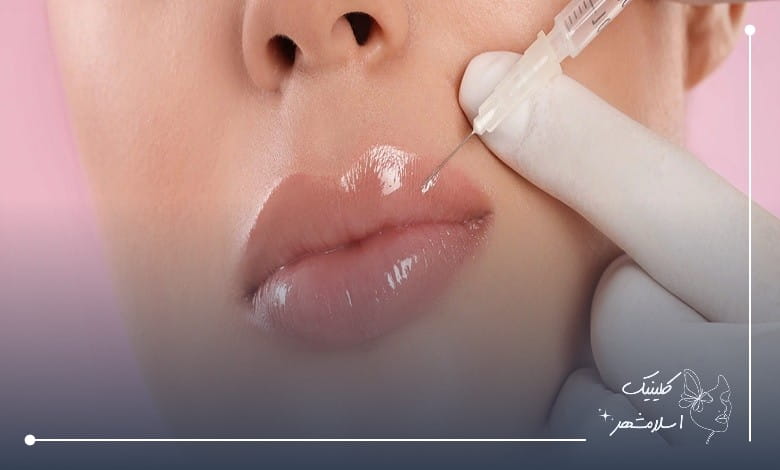 راهنمای انتخاب کلینیک برای تزریق آنزیم لب اقساطی